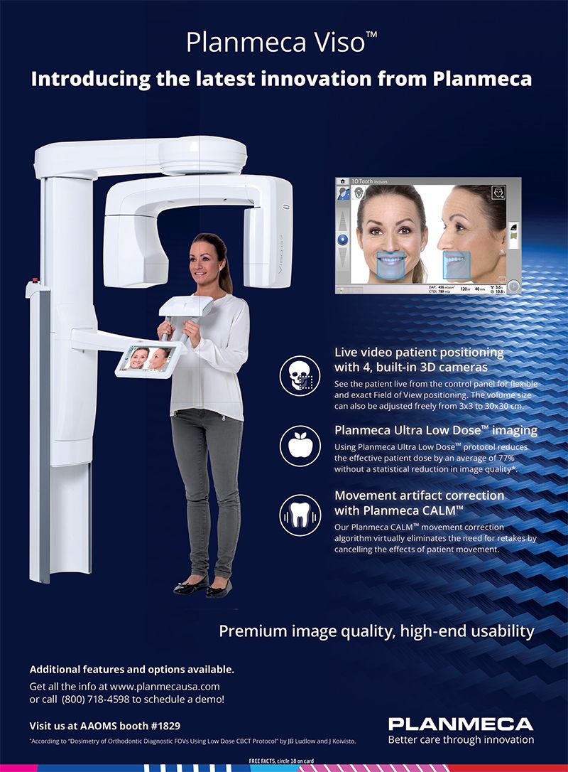 The Planmeca Viso G7 cone-beam scanner in the office